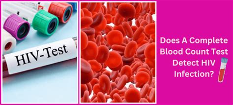 early hiv cbc results|Blood Work: A Complete Guide for Monitoring HIV.